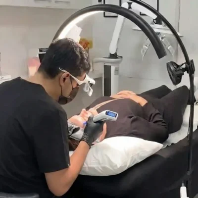 What is Skin Needling