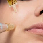 Skin Needling