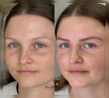 Eyebrow Tattooing