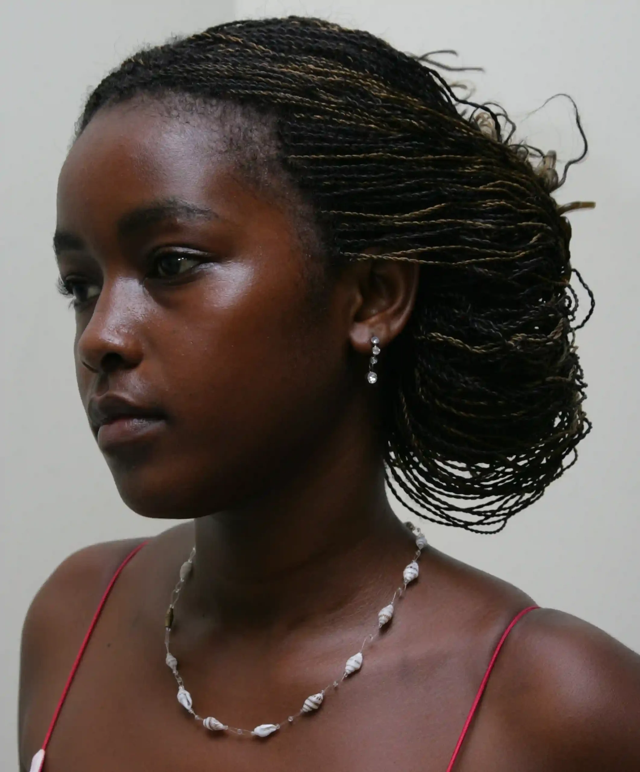 Laser Hair Removal For Dark Skin