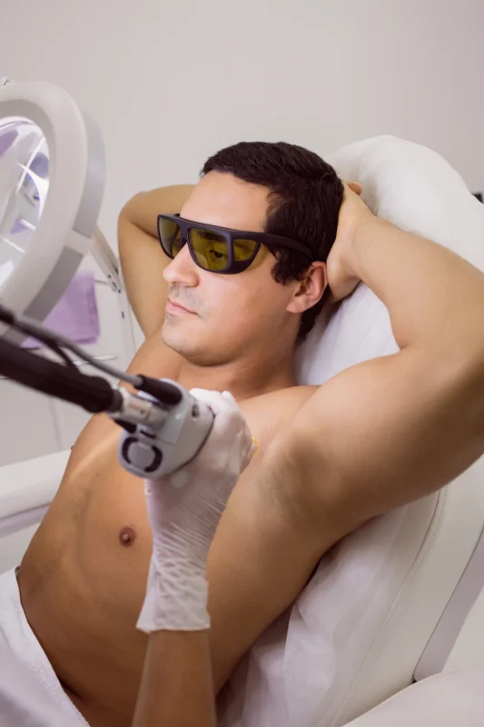 What Is Laser Hair Removal for Men