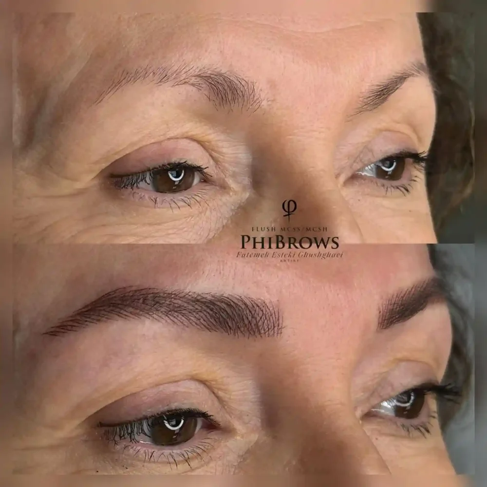 What Is Cosmetic Eyebrow Tattooing